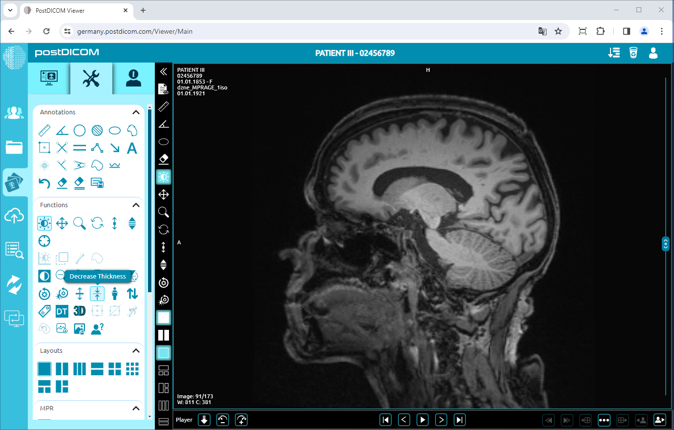 Using Negate, Rotate, Flip Vertical/Horizontal, Increase/Decrease Thickness, Zoom In/Out, Reset Functions