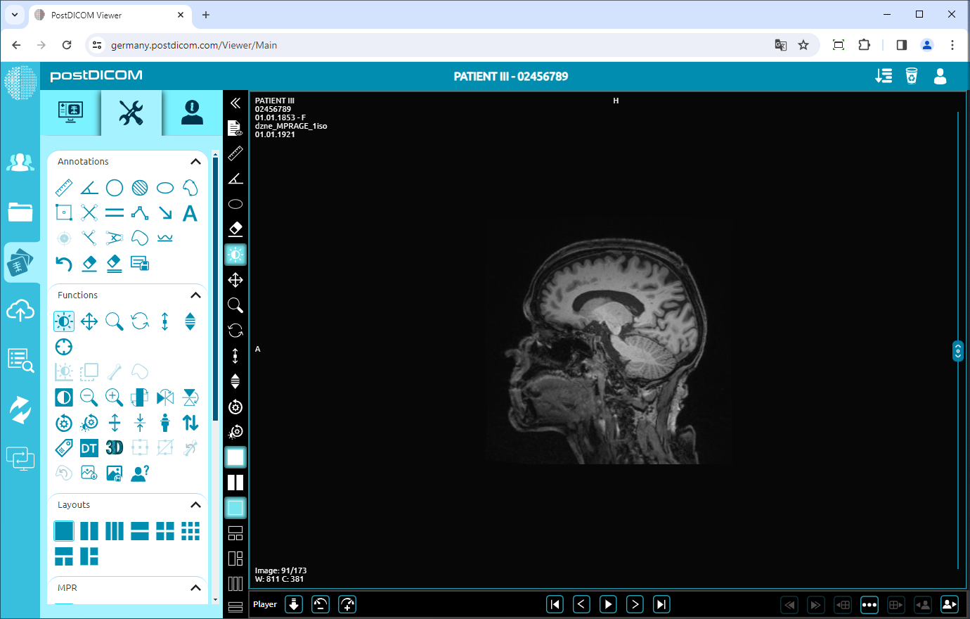 Using Negate, Rotate, Flip Vertical/Horizontal, Increase/Decrease Thickness, Zoom In/Out, Reset Functions