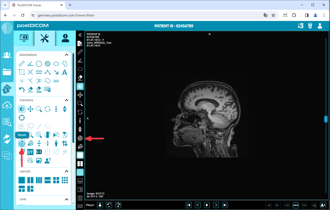 Using Negate, Rotate, Flip Vertical/Horizontal, Increase/Decrease Thickness, Zoom In/Out, Reset Functions