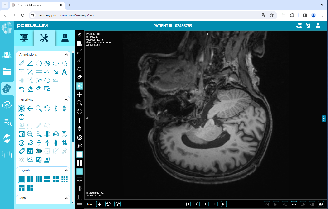 Using Negate, Rotate, Flip Vertical/Horizontal, Increase/Decrease Thickness, Zoom In/Out, Reset Functions