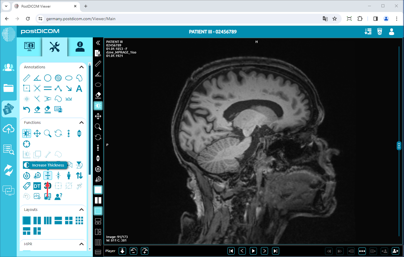 Using Negate, Rotate, Flip Vertical/Horizontal, Increase/Decrease Thickness, Zoom In/Out, Reset Functions