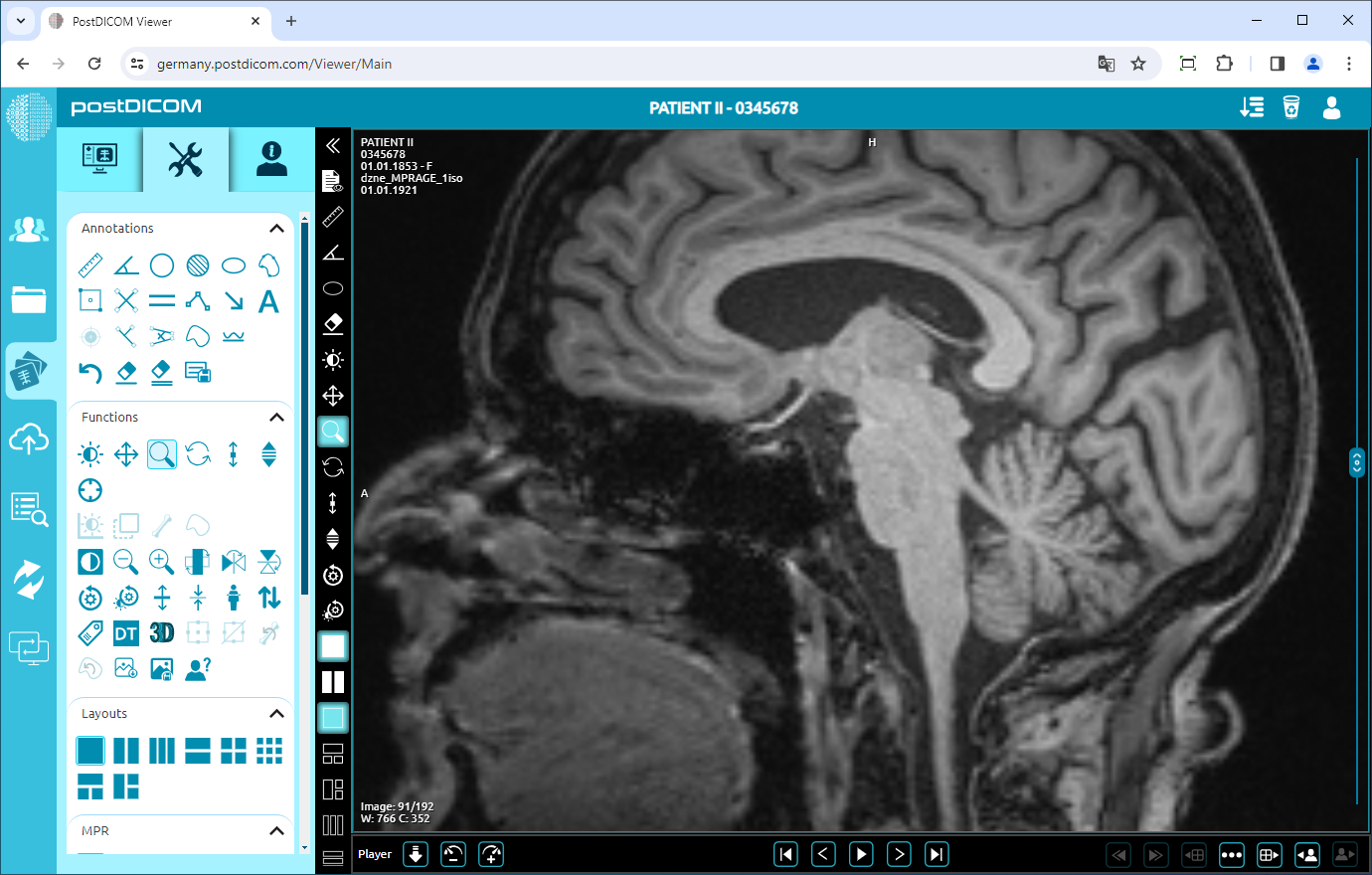 Using Window Level, Pan, Zoom, Rotation, Thickness and Scroll Functions