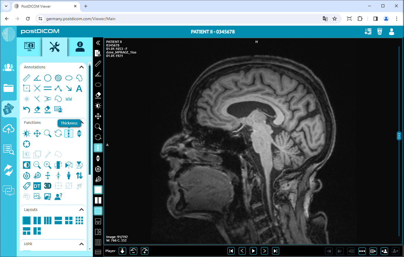 Using Window Level, Pan, Zoom, Rotation, Thickness and Scroll Functions