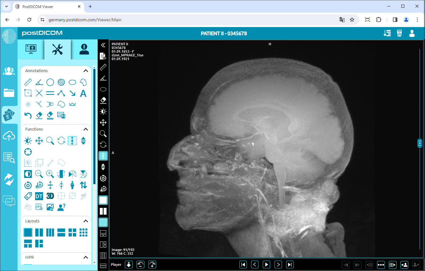 Using Window Level, Pan, Zoom, Rotation, Thickness and Scroll Functions