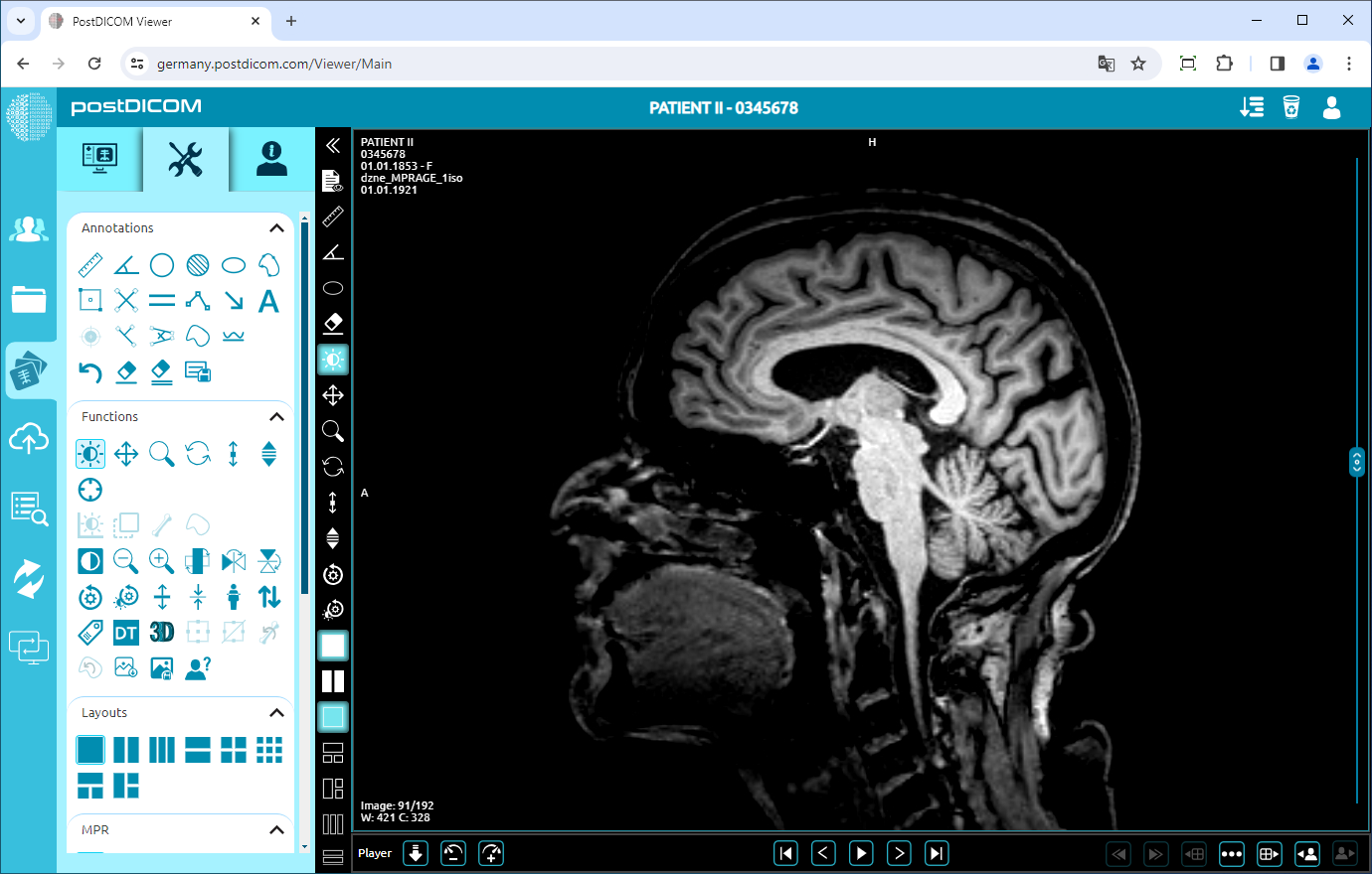 Using Window Level, Pan, Zoom, Rotation, Thickness and Scroll Functions