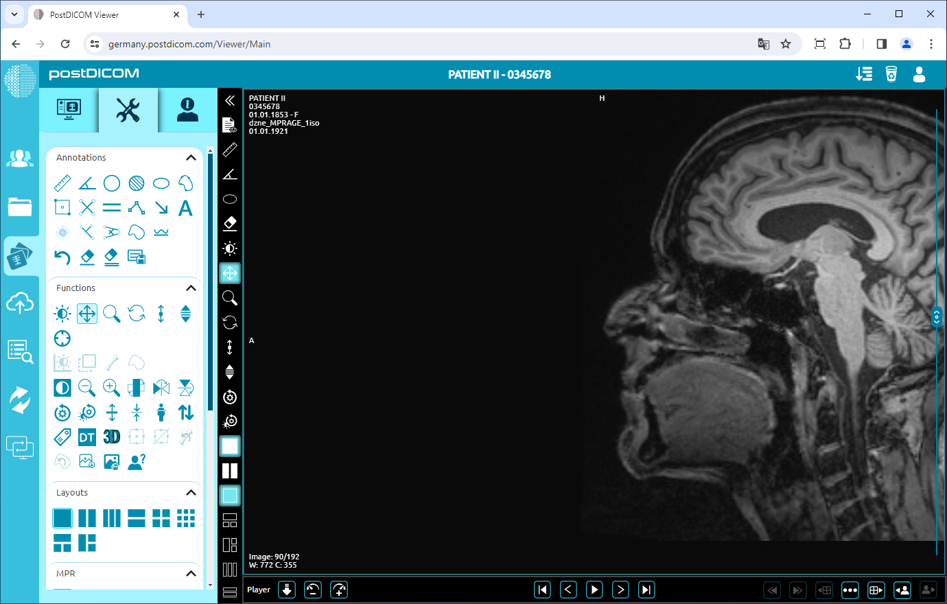 Using Window Level, Pan, Zoom, Rotation, Thickness and Scroll Functions